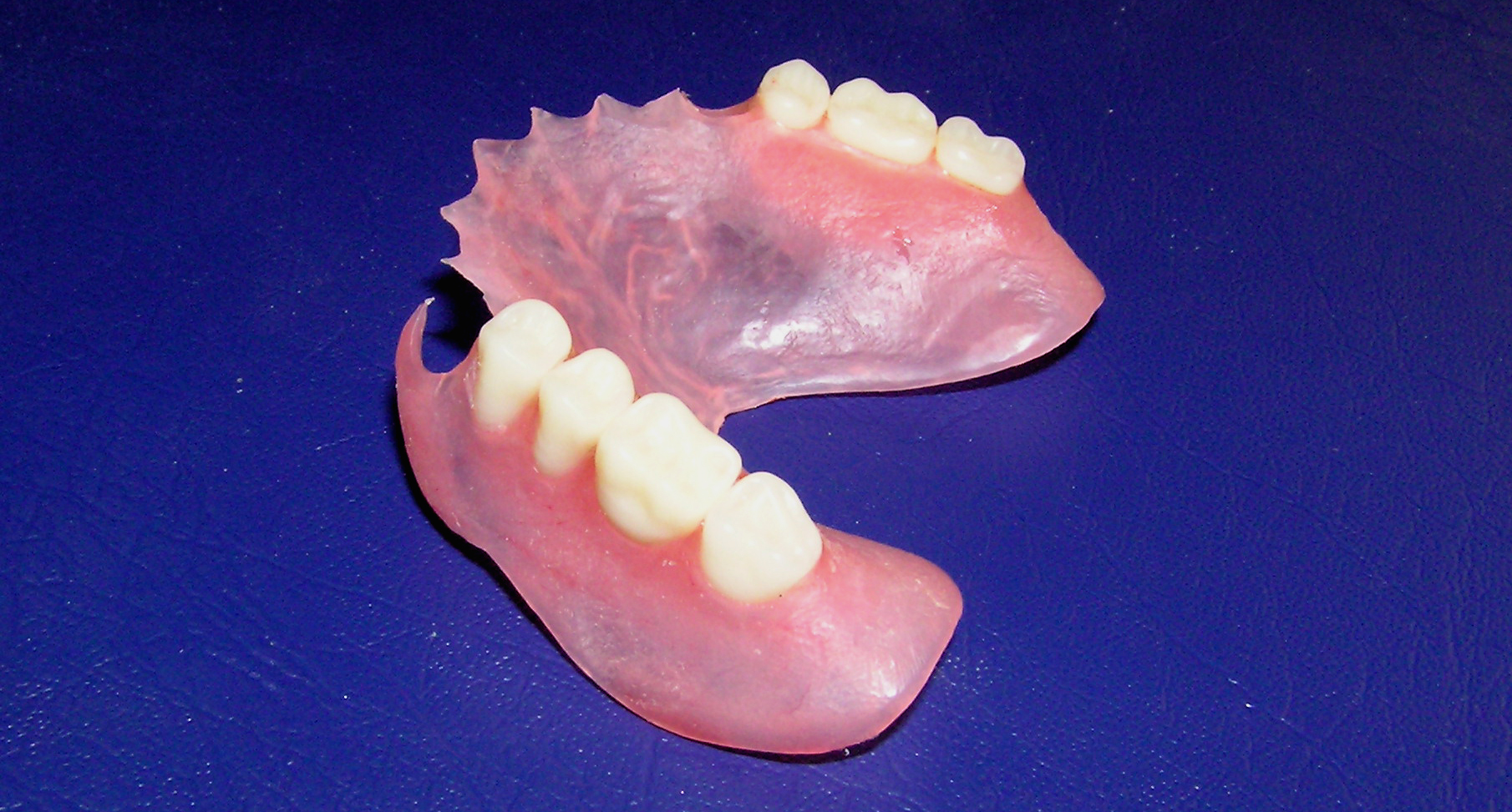 flexible partial dentures